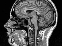 Image result for image MRI